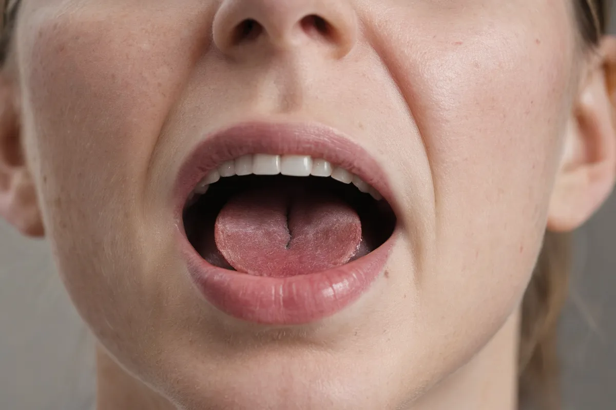 La concentración de IgM indica una posible infección virulente como la gripe o el sarna