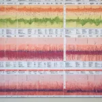 Inmunoglobulina M Alta: Indicador de Enfermedades Virales