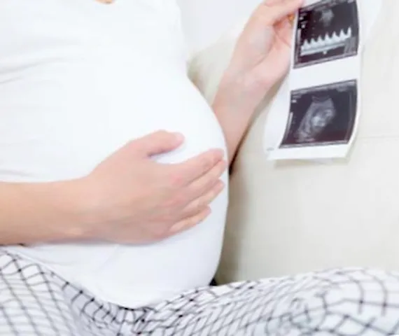 liquido amniotico color amarillo